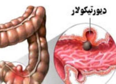 درمان بیماری دیورتیکولار با تغذیه مناسب درمان بیماری دیورتیکولار با تغذیه مناسب
